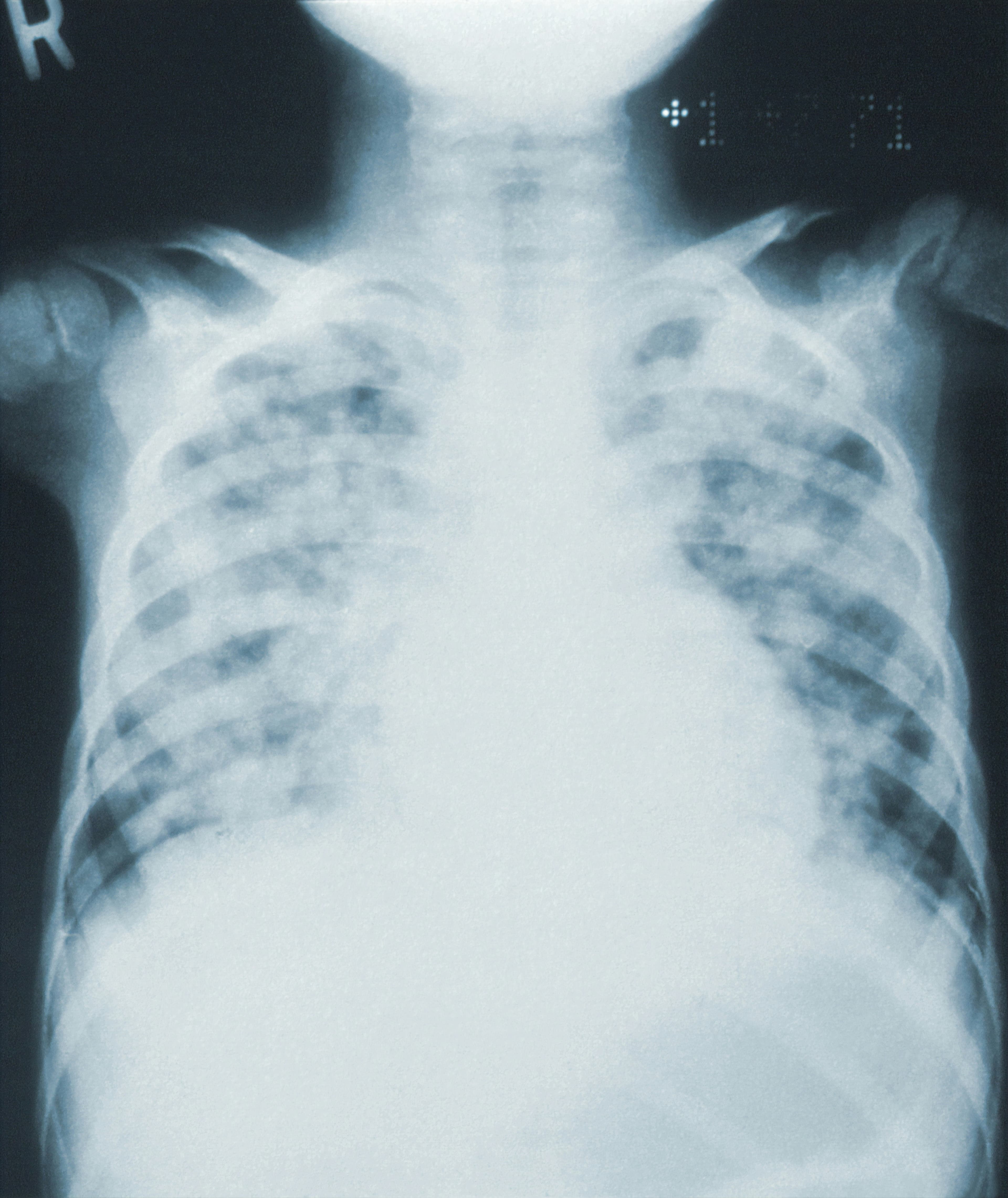Illustration La computer vision par TDM pour identifier les patients inconnus