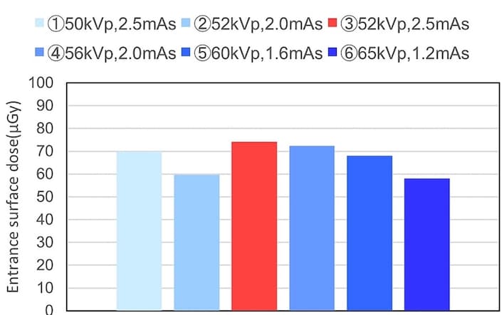 Illustration De nouvelles données pour optimiser l'irradiation des nouveau-nés en radiologie mobile