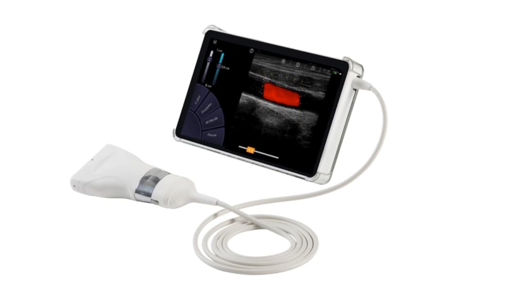 Illustration Sonoscanner livre 150 échographes ultraportables en Ukraine