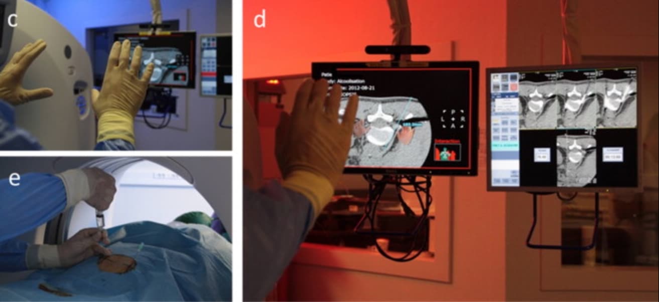 Les technologies du jeu vidéo au service du radiologue interventionnel