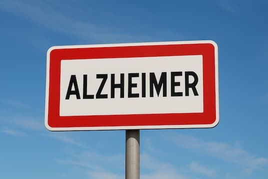 Illustration Mieux identifier par IRM les effets secondaires des traitements anti-amyloïde