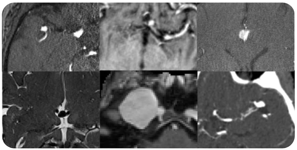 Illustration Le RSNA AI Challenge 2025 a rendu son verdict