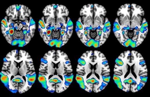 Illustration L'IRM fonctionnelle explique les comportements fanatiques à travers celui des supporters de football
