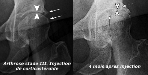 25 des jeux de mots Anabolisants injectables les plus drôles que vous puissiez trouver