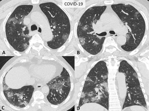 RADIOLOGIE, CT SCANNER ET IRM à vendre à Centre d'Affaires Médical