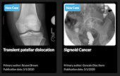 RSNA Cases