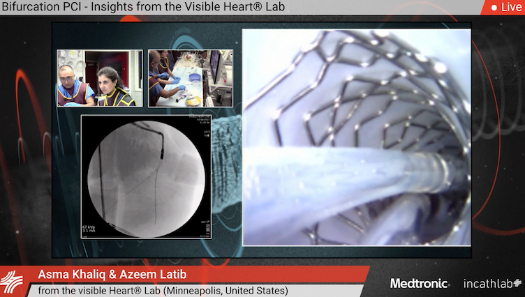 Innovations for the videotaped percutaneous treatment of coronary artery bifurcation