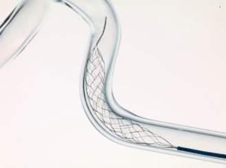 Stent retriever