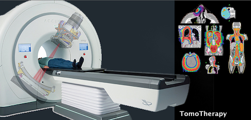 TomoTherapy